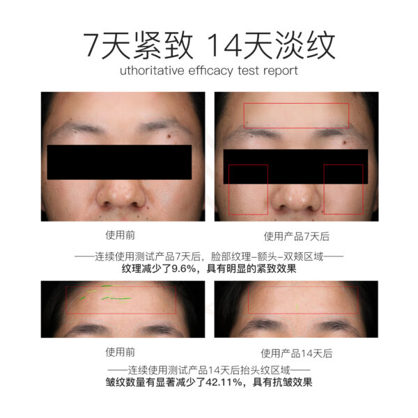 红花械紧塑抚纹系列