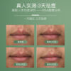 净痘清颜舒缓精华液